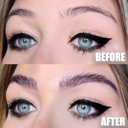 brow before after